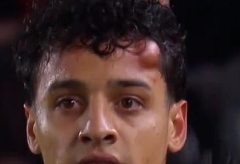 Tiago Palacios se Retira por un Golpe en el Partido de Copa Libertadores