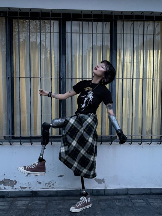 La lucha de una joven influencer por su calidad de vida y el acceso a prótesis biónicas